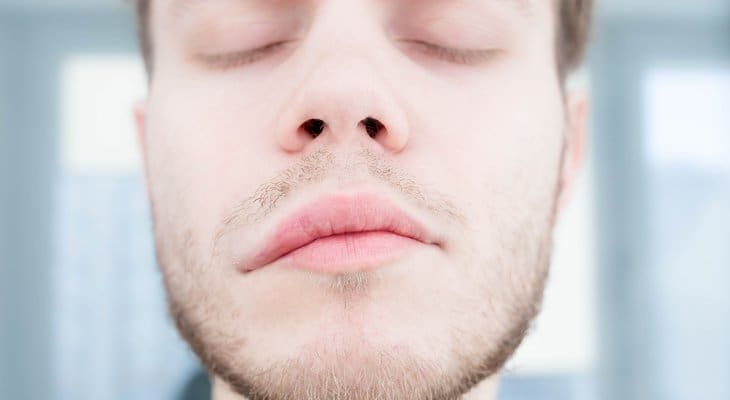 Bell's Palsy